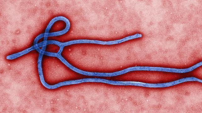 Ebola