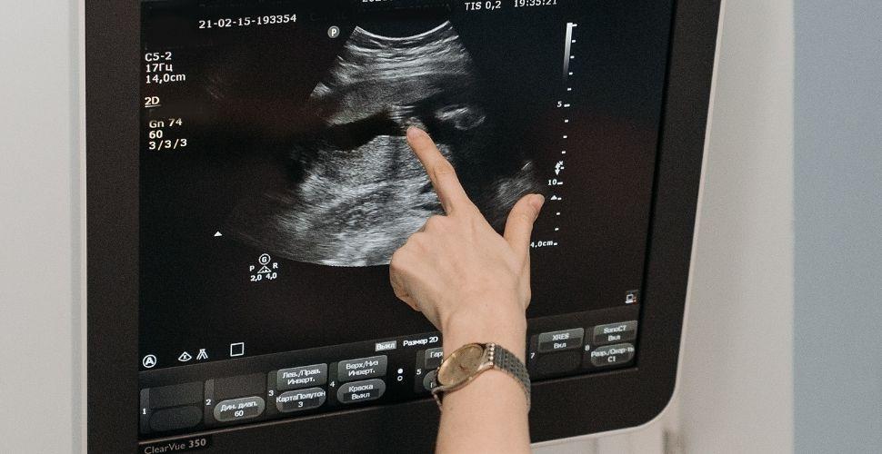 Imatge recurs d'una ecogafia